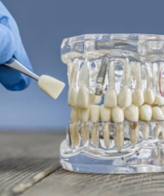 Гагарин.Протетика: полная совместимость с OSSTEM